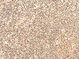 Immunohistochemistry of paraffin-embedded Human tonsil tissue using CCNE1 Polyclonal Antibody at dilution of 1:25(×200)
