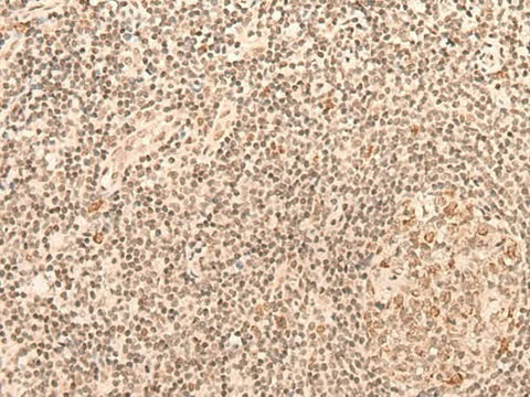 Immunohistochemistry of paraffin-embedded Human tonsil tissue using CCNE1 Polyclonal Antibody at dilution of 1:25(×200)