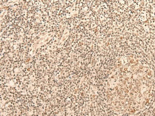 Immunohistochemistry of paraffin-embedded Human tonsil tissue using CCNE1 Polyclonal Antibody at dilution of 1:25(×200)