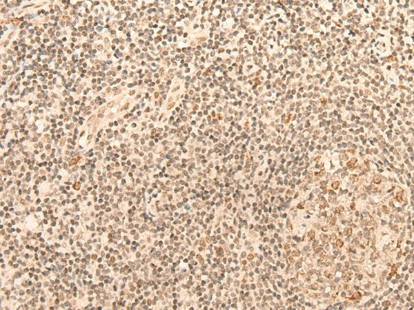 Immunohistochemistry of paraffin-embedded Human tonsil tissue using CCNE1 Polyclonal Antibody at dilution of 1:25(×200)