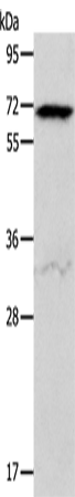 Anti-Human/Mouse/Rat ACVR2A Antibody - ABMIUM
