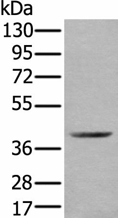 Western blot analysis of Mouse kidney tissue lysate using WDFY2 Polyclonal Antibody at dilution of 1:350