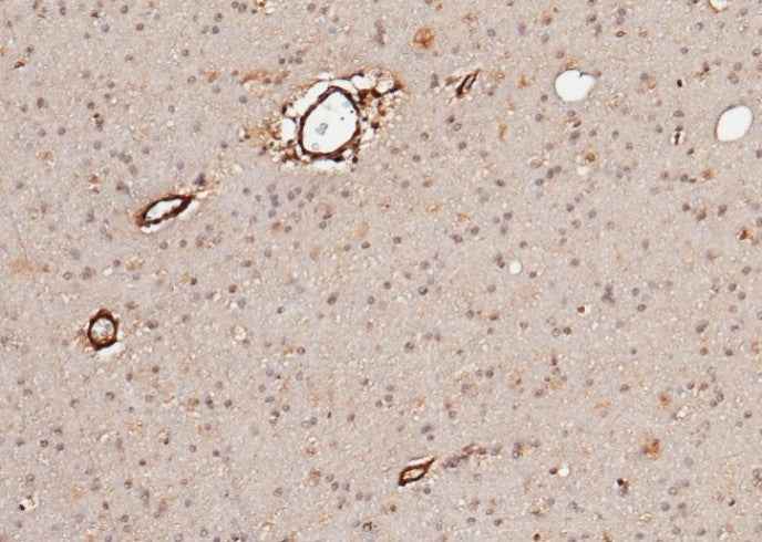 Anti-Human NLGN1 Antibody [B154] - ABMIUM