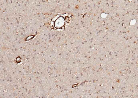 Anti-Human NLGN1 Antibody [B154] - ABMIUM