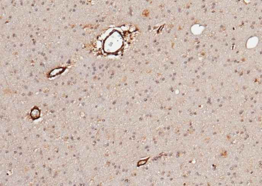 Anti-Human NLGN1 Antibody [B154] - ABMIUM