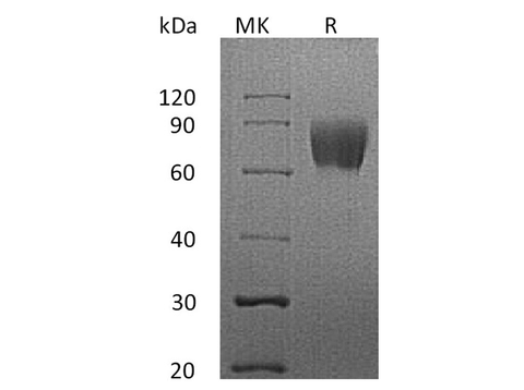 Recombinant Human LFA-3/CD58 Protein (Fc Tag) - ABMIUM