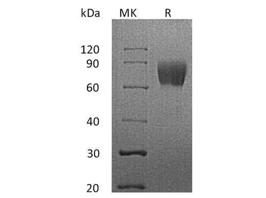 Recombinant Human LFA-3/CD58 Protein (Fc Tag) - ABMIUM