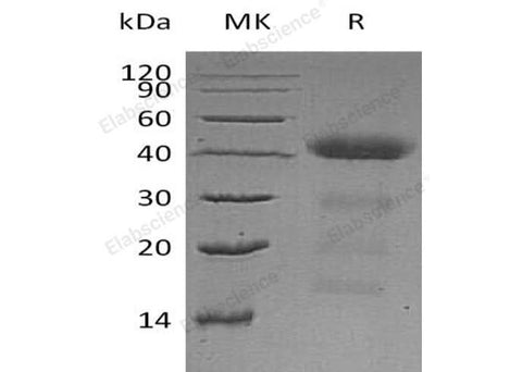 Recombinant Human ZAG/AZGP1 Protein (His Tag) - ABMIUM
