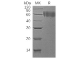Recombinant Human DR6/TNFRSF21 Protein (His Tag) - ABMIUM