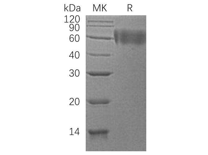 Recombinant Human DR6/TNFRSF21 Protein (His Tag) - ABMIUM