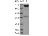 Recombinant Human CALR/Calreticulin Protein (Fc Tag) - ABMIUM