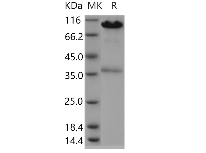 Recombinant Human CALR/Calreticulin Protein (Fc Tag) - ABMIUM