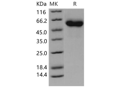 SDS-PAGE analysis of Human Complement Factor H/CFH proteins, 2 μg/lane of Recombinant Human Complement Factor H/CFH proteins was resolved with SDS-PAGE under reducing conditions, showing bands at 60 kDa.