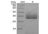 Recombinant Human Apolipoprotein D/ApoD Protein (His Tag) - ABMIUM