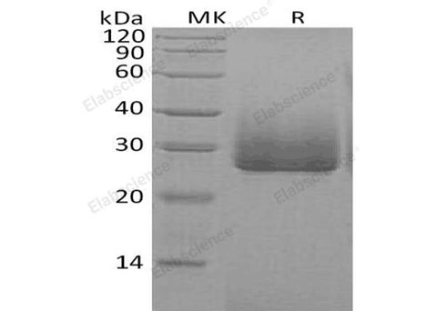 Recombinant Human Apolipoprotein D/ApoD Protein (His Tag) - ABMIUM