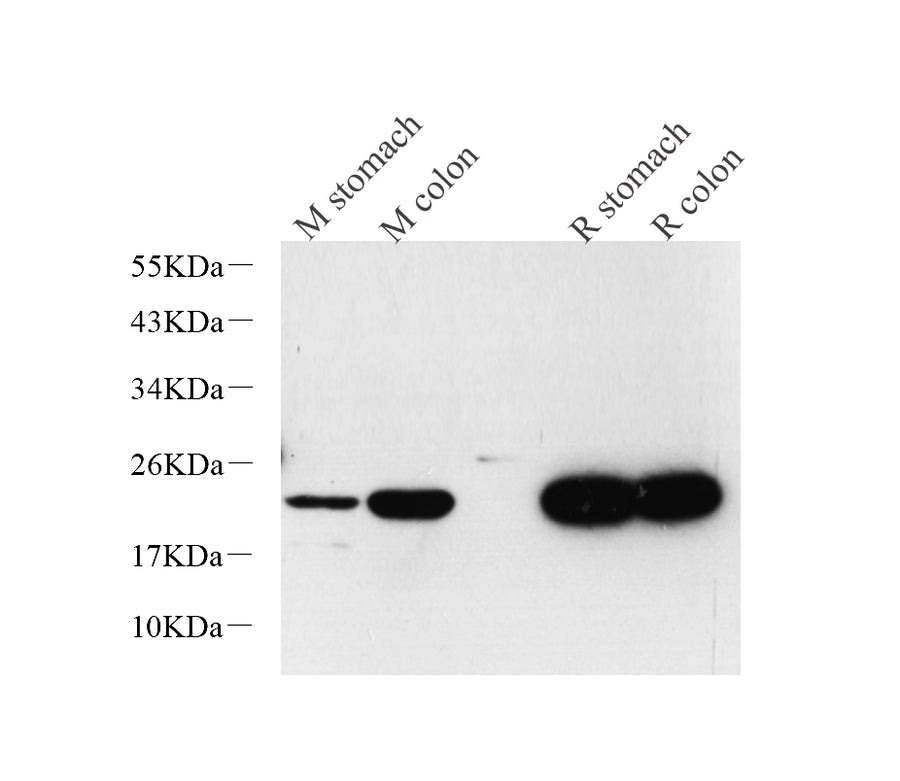Western Blot analysis of various samples using TAGLN Polyclonal Antibody at dilution of 1:600.