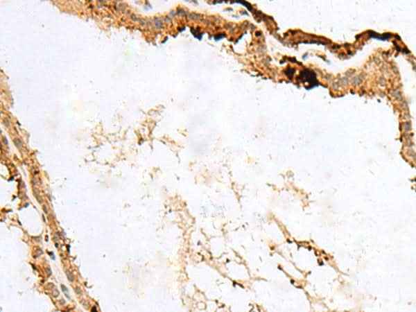 Anti-Human/Mouse/Rat RABGGTA Antibody