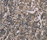 Anti-Human MCC Antibody - ABMIUM