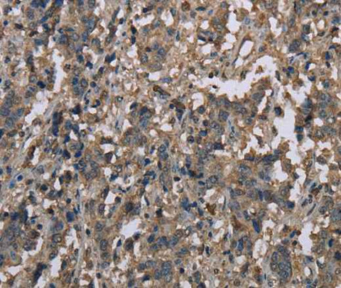 Anti-Human MCC Antibody