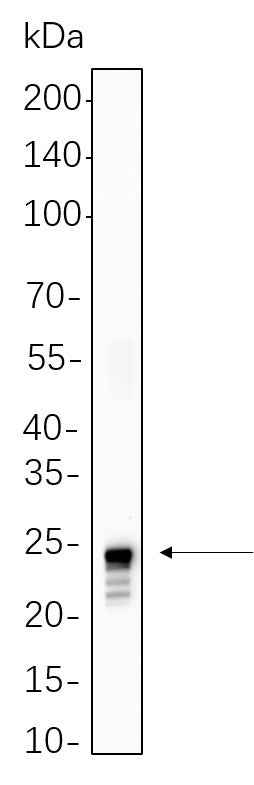 Anti-Human/Mouse/Rat Histone H2A Antibody [B1089] - ABMIUM