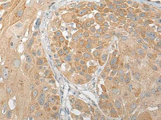 Anti-Human/Mouse SNX6 Antibody