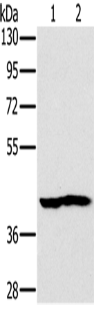 Anti-Human/Mouse NDUFA10 Antibody - ABMIUM