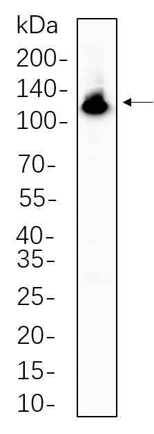 Anti-Human/Mouse/Rat NFkB-p100 Antibody [B661] - ABMIUM