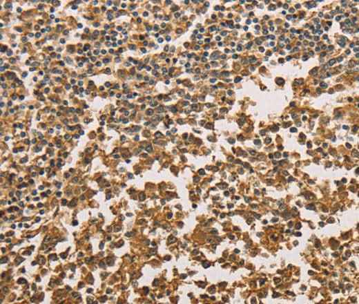 Anti-Human/Mouse SETD2 Antibody