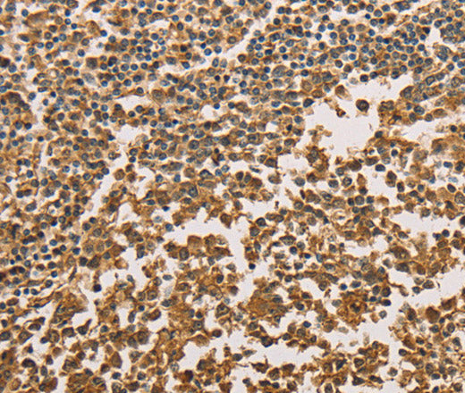 Anti-Human/Mouse SETD2 Antibody - ABMIUM