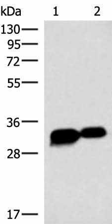 Western blot analysis of HepG2 cell Mouse heart tissue lysates using HCCS Polyclonal Antibody at dilution of 1:4000