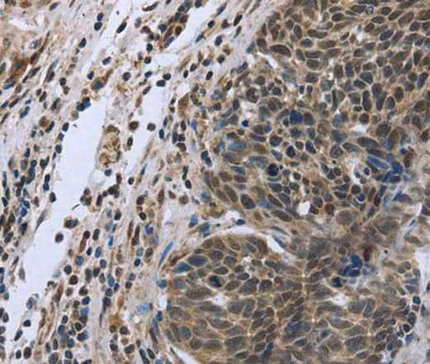 Anti-Human FANCG Antibody