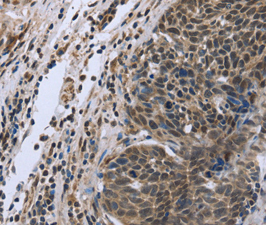 Anti-Human FANCG Antibody - ABMIUM