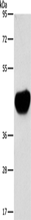 Anti-Human/Mouse/Rat ACTA2 Antibody - ABMIUM