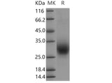 Recombinant Human RAMP3 Protein (Fc Tag) - ABMIUM