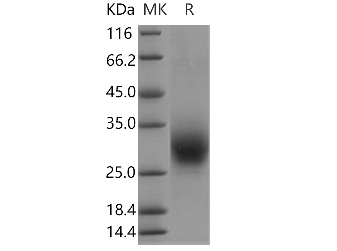 Recombinant Human RAMP3 Protein (Fc Tag) - ABMIUM