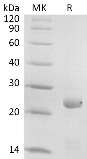 Recombinant SARS-CoV-2 S Protein HR1 (N-6His-Sumo) - ABMIUM