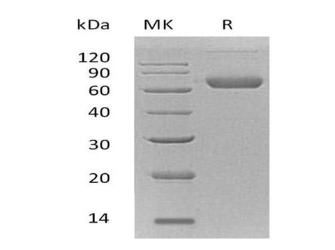 Recombinant Mouse Ephrin-B2/EFNB2 Protein (Fc & His Tag) - ABMIUM