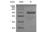 Recombinant Human Kallikrein 5/KLK5 Protein (His Tag) - ABMIUM