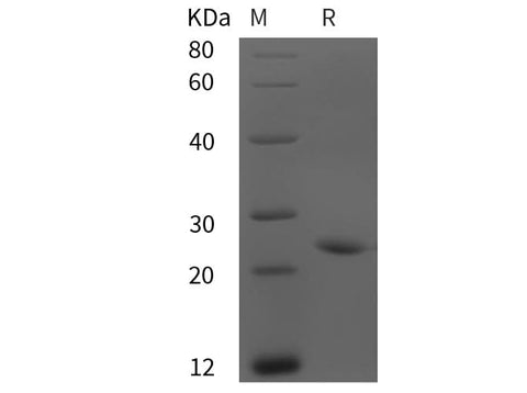 SDS-PAGE analysis of Rat Adrenomedullin/ADM proteins, 2 μg/lane of Recombinant Rat Adrenomedullin/ADM proteins was resolved with SDS-PAGE under reducing conditions, showing bands at 25 kDa.