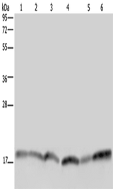 Anti-Human/Mouse/Rat RHEB Antibody - ABMIUM