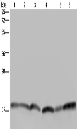 Anti-Human/Mouse/Rat RHEB Antibody - ABMIUM