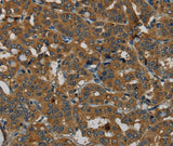 Anti-Human PDE5A Antibody - ABMIUM