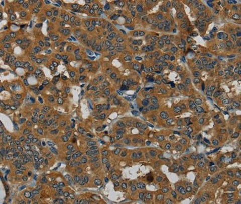 Anti-Human PDE5A Antibody - ABMIUM