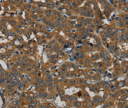 Anti-Human PDE5A Antibody - ABMIUM