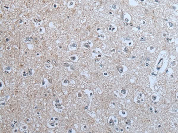 Immunohistochemistry of paraffin-embedded Human brain tissue using BRSK2 Polyclonal Antibody at dilution of 1:70(×200)