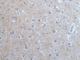 Immunohistochemistry of paraffin-embedded Human brain tissue using BRSK2 Polyclonal Antibody at dilution of 1:70(×200)