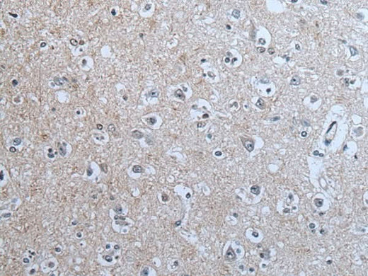 Immunohistochemistry of paraffin-embedded Human brain tissue using BRSK2 Polyclonal Antibody at dilution of 1:70(×200)
