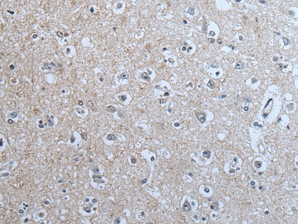 Immunohistochemistry of paraffin-embedded Human brain tissue using BRSK2 Polyclonal Antibody at dilution of 1:70(×200)
