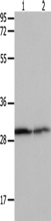 Anti-Human/Mouse/Rat 14-3-3 beta/alpha Antibody - ABMIUM