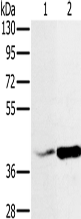 Anti-Human NDUFA10 Antibody - ABMIUM